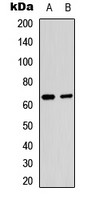 NFkB p65 (Acetyl Lys221) antibody
