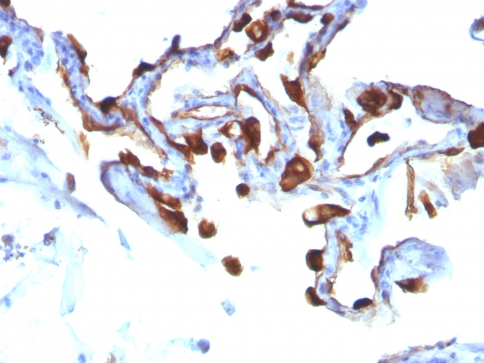 Cytokeratin 8 antibody [KRT8/803]