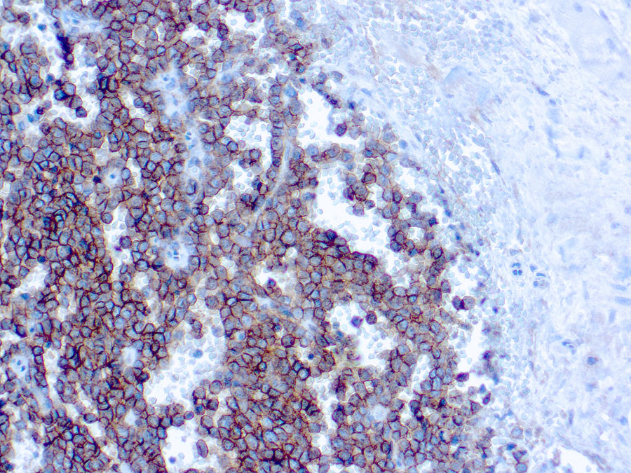 CD99 antibody [HO36-1.1]