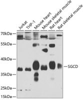 delta Sarcoglycan antibody