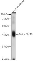 Factor IX antibody