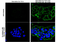 EGFR (phospho Tyr1148) antibody