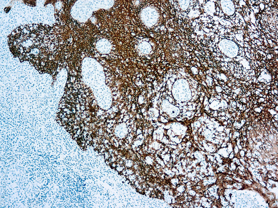 pan Cytokeratin antibody [MNF116]