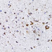 Retinoic Acid Receptor alpha antibody