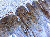 Human Papillomavirus type 16 L1 antibody [CamVir 1]