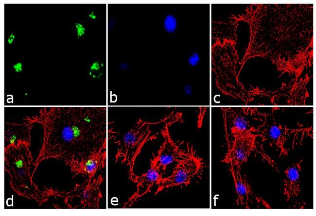 CXCL8 / IL8 antibody [3IL8-H10]