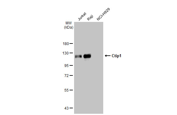 Ctip1 antibody [GT1341]
