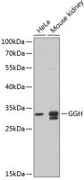 Glutamyl hydrolase gamma antibody