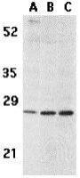 BCMA antibody