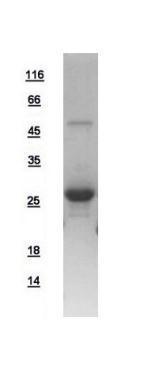 Human RAB5A protein, His tag