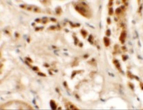 SIGLEC15 antibody