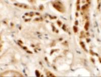 SIGLEC15 antibody