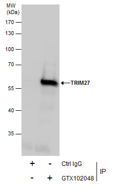 TRIM27 antibody