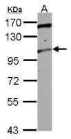 TRAK2 antibody