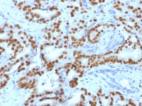 FOXA1 antibody [FOXA1/1519]