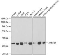 AKR1B1 antibody