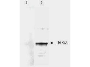 LEFTY2 antibody [7C5G1H6H10]