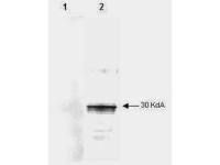 LEFTY2 antibody [7C5G1H6H10]