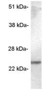 SCAMP 5 antibody