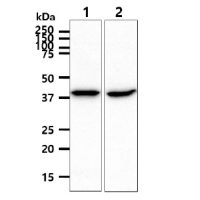 ACADS antibody [AT8B10]