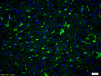 PGT antibody