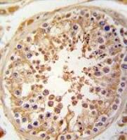 JLP antibody, N-term
