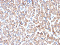 HSP60 antibody [HSPD1/2206R]