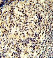 SNRPD1 antibody, C-term