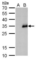 Neurogenin 1 antibody