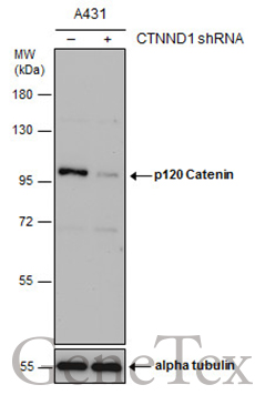 p120 Catenin antibody