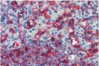 HLA-E antibody [MEM-E/06]