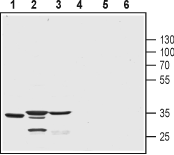 CSEN antibody
