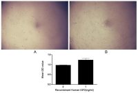 Human IGF2 protein, His tag (active)