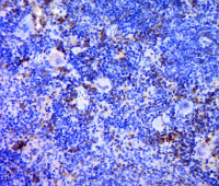 TREML1 antibody