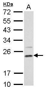 DHFR antibody