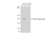 PDGF Receptor alpha antibody [JF104-6]