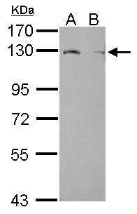 Lipin 1 antibody [N3C2], Internal