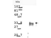 Cyclin D1 antibody