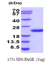 Human UBE2G2 protein, His tag