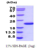 Human UBE2G2 protein, His tag