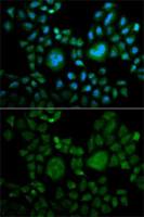 Carbonic Anhydrase II antibody