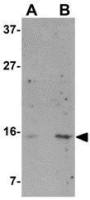 Norrin antibody