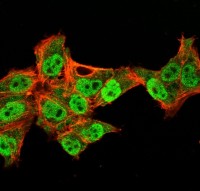 p63 antibody [TP40/3980R]