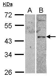 VPAC2 antibody [C2C3], C-term
