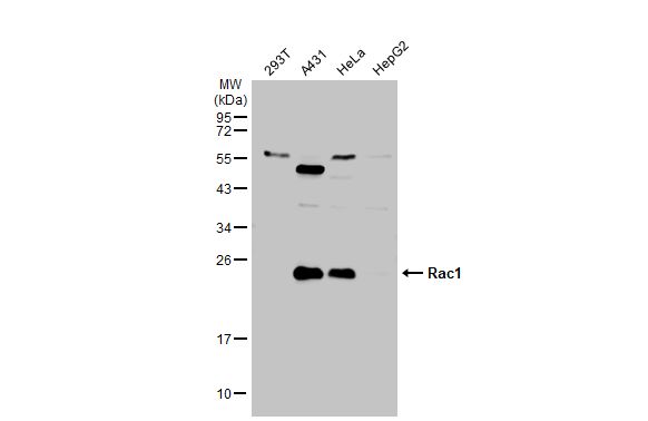 Rac1 antibody