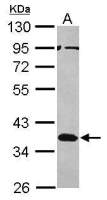 Musashi 2 antibody [N1C1]