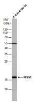 Kiss1 antibody