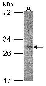 IL22 Receptor alpha 2 antibody