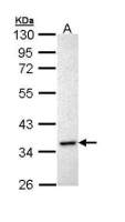 Inhibin alpha antibody [N2C3]