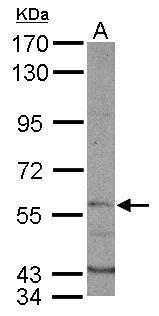 DYRK1B antibody